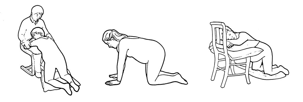 Kneeling Delivery Positions